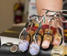 Студенты разработали перчатку, которая поможет в реабилитации пациентам после инсульта