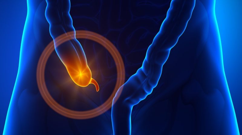 С какой стороны аппендицит: месторасположение аппендикса, основные симптомы